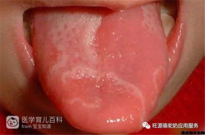一位女中医的震惊：中国孩子比我们想象的更虚寒！